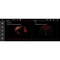 DIGITAL IQ TOP 17972_CPA (12.3'') MULTIMEDIA SYSTEM for BMW X3 (F25) mod. 2011-2013 (CIC)